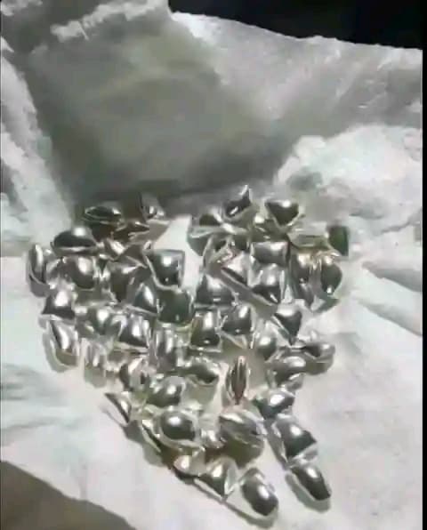 removable silver and gold tooth caps 