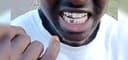 silver and gold tooth caps 0792857761's website