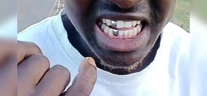 silver and gold tooth caps 0792857761